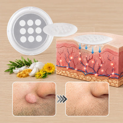 👉 PuraCure® 2 az 1-ben mikrotűs és hidrokolloid tapasz🧑‍⚕️ | Kiálló anyajegyek, aknék, lapos szemölcsök és bőrnövedékek eltávolítására | Segít csökkenteni a ráncokat, hegeket és bőrhibákat | Láthatatlan tapasz az arcra és testre