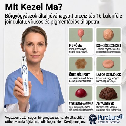 💖PuraCure® 👩‍⚕️ 𝟕 𝐍𝐚𝐩𝐨𝐬 Bőrkinövés- és Folteltávolító Toll Fájdalommentes és Hegmentes Professzionális Rollerball