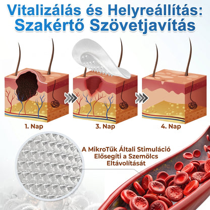 👉 PuraCure® 2 az 1-ben mikrotűs és hidrokolloid tapasz🧑‍⚕️ | Kiálló anyajegyek, aknék, lapos szemölcsök és bőrnövedékek eltávolítására | Segít csökkenteni a ráncokat, hegeket és bőrhibákat | Láthatatlan tapasz az arcra és testre