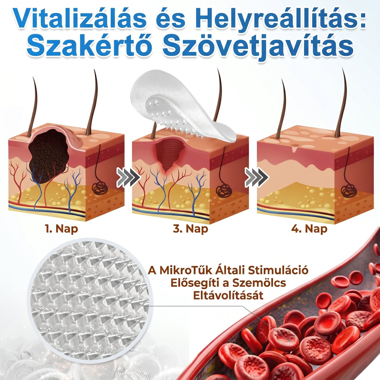 🌟 PuraCure® 2 az 1-ben mikrotűs és hidrokolloid tapasz🧑‍⚕️ | Kiálló anyajegyek, aknék, lapos szemölcsök és bőrnövedékek eltávolítására | Segít csökkenteni a ráncokat, hegeket és bőrhibákat | Láthatatlan tapasz az arcra és testre