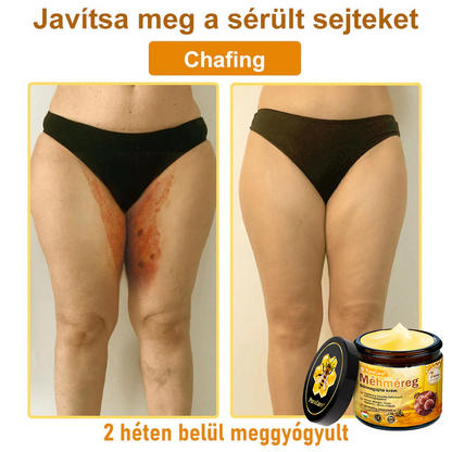 🛡️ 𝐏𝐮𝐫𝐚𝐂𝐮𝐫𝐞® 𝐌é𝐡𝐦é𝐫𝐞𝐠 𝐁ő𝐫 𝐇𝐞𝐥𝐲𝐫𝐞á𝐥𝐥í𝐭ó 𝐊𝐫é𝐦 (👨‍⚕‍𝐂𝐄 𝐓𝐚𝐧ú𝐬í𝐭𝐯á𝐧𝐲)👍✅