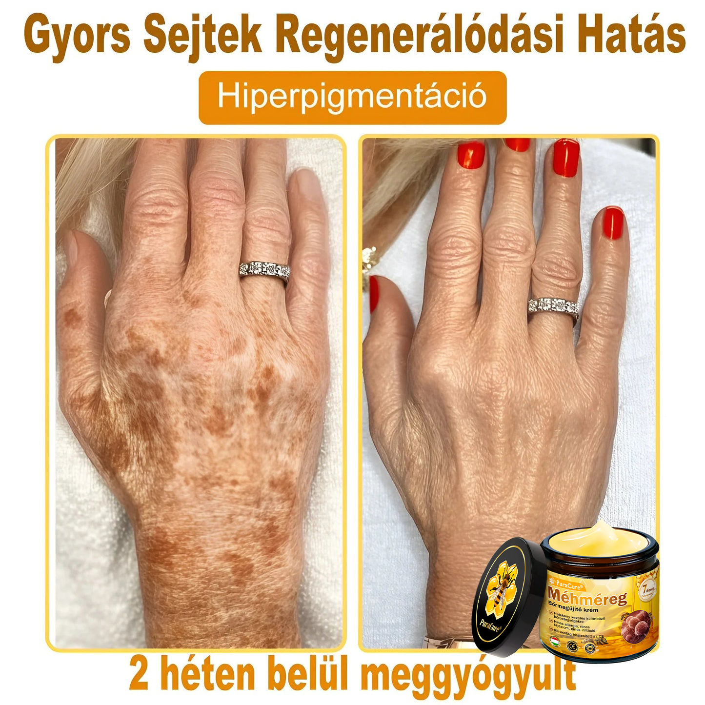 🛡️ 𝐏𝐮𝐫𝐚𝐂𝐮𝐫𝐞® 𝐌é𝐡𝐦é𝐫𝐞𝐠 𝐁ő𝐫 𝐇𝐞𝐥𝐲𝐫𝐞á𝐥𝐥í𝐭ó 𝐊𝐫é𝐦 (👨‍⚕‍𝐂𝐄 𝐓𝐚𝐧ú𝐬í𝐭𝐯á𝐧𝐲)👍✅