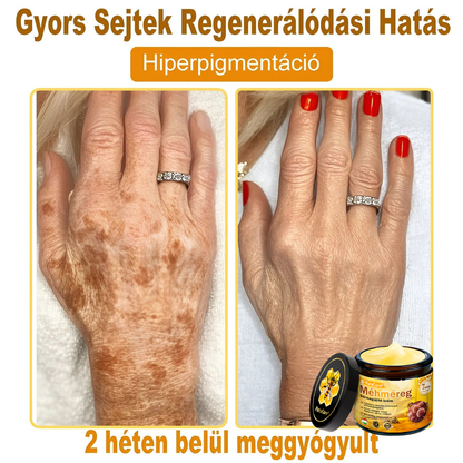 🛡️ 𝐏𝐮𝐫𝐚𝐂𝐮𝐫𝐞® 𝐌é𝐡𝐦é𝐫𝐞𝐠 𝐁ő𝐫 𝐇𝐞𝐥𝐲𝐫𝐞á𝐥𝐥í𝐭ó 𝐊𝐫é𝐦 (👨‍⚕‍𝐂𝐄 𝐓𝐚𝐧ú𝐬í𝐭𝐯á𝐧𝐲)👍✅