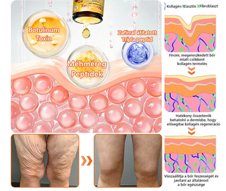 🛡️ 𝐏𝐮𝐫𝐚𝐂𝐮𝐫𝐞® 𝐌é𝐡𝐦é𝐫𝐞𝐠 𝐁ő𝐫 𝐇𝐞𝐥𝐲𝐫𝐞á𝐥𝐥í𝐭ó 𝐊𝐫é𝐦 (👨‍⚕‍𝐂𝐄 𝐓𝐚𝐧ú𝐬í𝐭𝐯á𝐧𝐲)👍✅