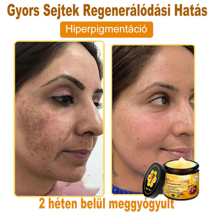 🛡️ 𝐏𝐮𝐫𝐚𝐂𝐮𝐫𝐞® 𝐌é𝐡𝐦é𝐫𝐞𝐠 𝐁ő𝐫 𝐇𝐞𝐥𝐲𝐫𝐞á𝐥𝐥í𝐭ó 𝐊𝐫é𝐦 (👨‍⚕‍𝐂𝐄 𝐓𝐚𝐧ú𝐬í𝐭𝐯á𝐧𝐲)👍✅