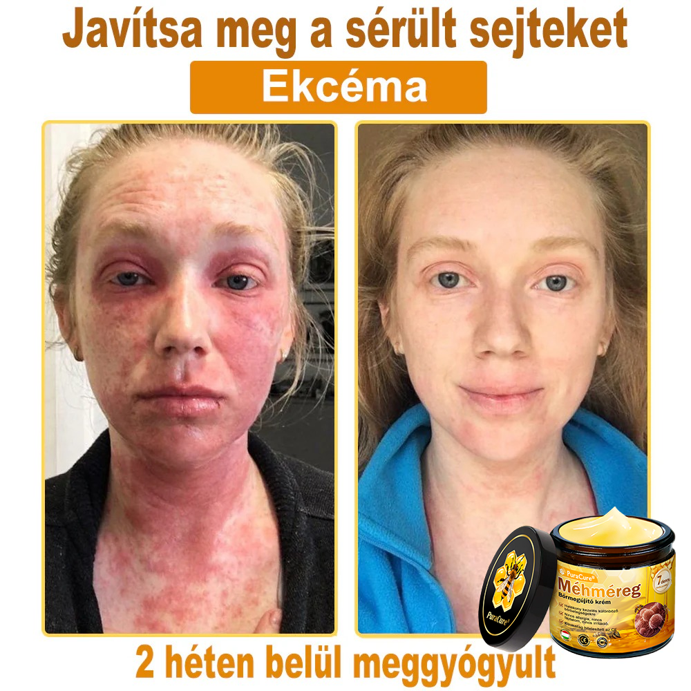 🛡️ 𝐏𝐮𝐫𝐚𝐂𝐮𝐫𝐞® 𝐌é𝐡𝐦é𝐫𝐞𝐠 𝐁ő𝐫 𝐇𝐞𝐥𝐲𝐫𝐞á𝐥𝐥í𝐭ó 𝐊𝐫é𝐦 (👨‍⚕‍𝐂𝐄 𝐓𝐚𝐧ú𝐬í𝐭𝐯á𝐧𝐲)👍✅