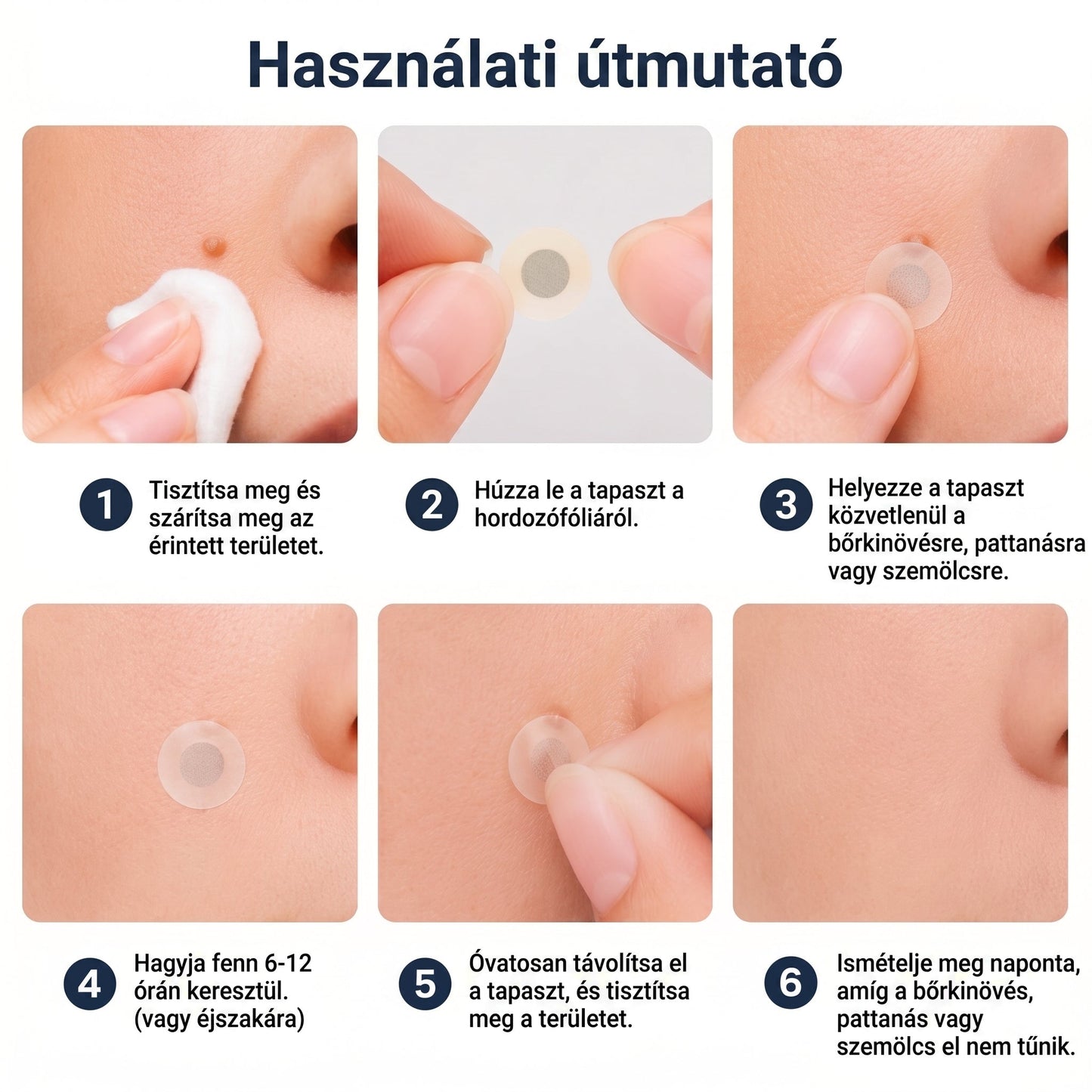 👉 PuraCure® 2 az 1-ben mikrotűs és hidrokolloid tapasz🧑‍⚕️ | Kiálló anyajegyek, aknék, lapos szemölcsök és bőrnövedékek eltávolítására | Segít csökkenteni a ráncokat, hegeket és bőrhibákat | Láthatatlan tapasz az arcra és testre