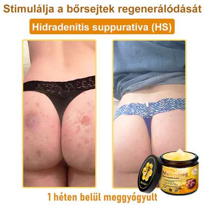 🛡️ 𝐏𝐮𝐫𝐚𝐂𝐮𝐫𝐞® 𝐌é𝐡𝐦é𝐫𝐞𝐠 𝐁ő𝐫 𝐇𝐞𝐥𝐲𝐫𝐞á𝐥𝐥í𝐭ó 𝐊𝐫é𝐦 (👨‍⚕‍𝐂𝐄 𝐓𝐚𝐧ú𝐬í𝐭𝐯á𝐧𝐲)👍✅