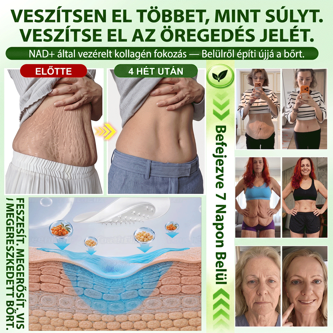 🔥Hivatalos Áruház |🍀BSWELL® Moringa × Berberin × NAD+ 10 az 1-ben Nano Mikrotűs Tapasz (Naponta egyszer, látható változások 7 nap után) ✅ Elhízás, megereszkedett bőr, cukorbetegség, alvási apnoé, ízületi problémák