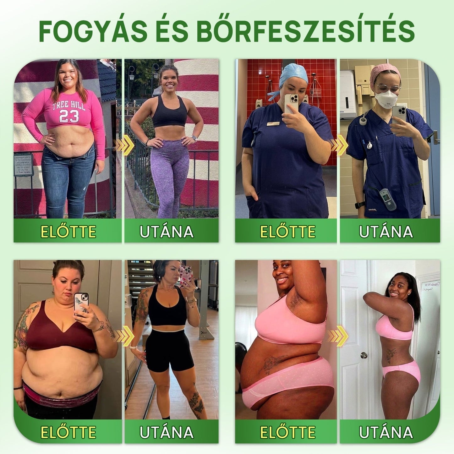 🔥Hivatalos Áruház |🍀BSWELL® Moringa × Berberin × NAD+ 10 az 1-ben Nano Mikrotűs Tapasz (Naponta egyszer, látható változások 7 nap után) ✅ Elhízás, megereszkedett bőr, cukorbetegség, alvási apnoé, ízületi problémák