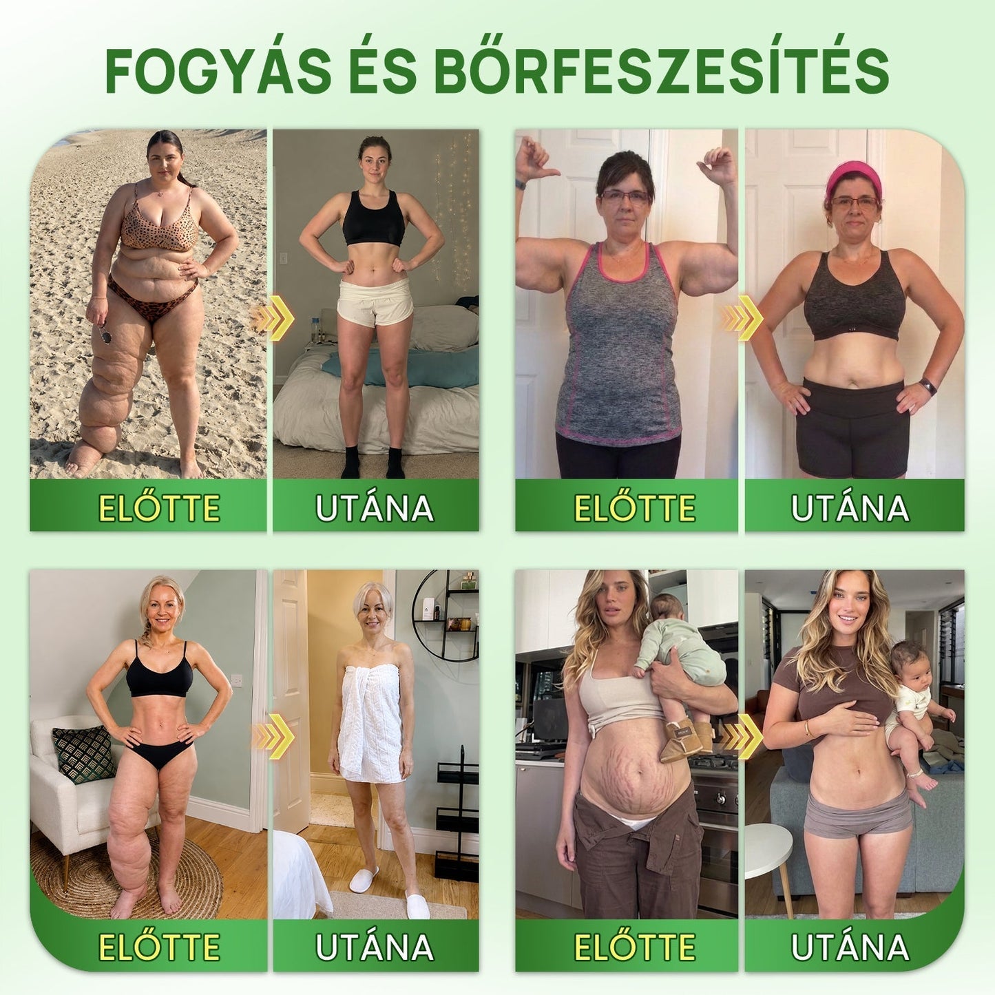 🔥Hivatalos Áruház |🍀BSWELL® Moringa × Berberin × NAD+ 10 az 1-ben Nano Mikrotűs Tapasz (Naponta egyszer, látható változások 7 nap után) ✅ Elhízás, megereszkedett bőr, cukorbetegség, alvási apnoé, ízületi problémák